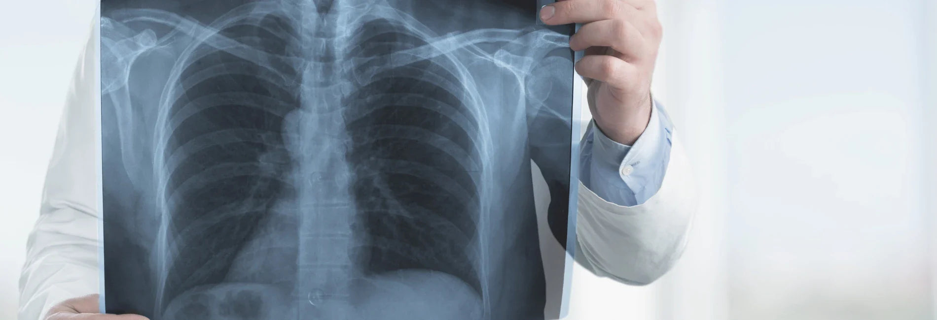 The specific effect of oxygen concentrator on pulmonary fibrosis