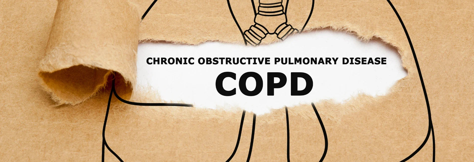 Home treatment measures for COPD: these 5 points can keep the condition stable